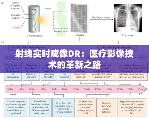 射线实时成像DR：医疗影像技术的革新之路