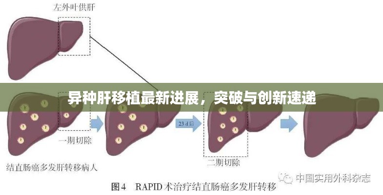 异种肝移植最新进展，突破与创新速递